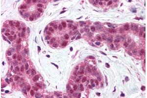 Human Breast (formalin-fixed, paraffin-embedded) stained with BCL10 antibody ABIN214584 at 5 ug/ml followed by biotinylated goat anti-rabbit IgG secondary antibody ABIN481713, alkaline phosphatase-streptavidin and chromogen. (BCL10 antibody  (N-Term))