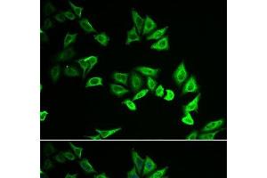Immunofluorescence analysis of U2OS cells using MYOZ2 Polyclonal Antibody