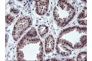 Immunohistochemical staining of paraffin-embedded Human breast tissue using anti-PDLIM2 mouse monoclonal antibody.