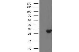 HEK293T cells were transfected with the pCMV6-ENTRY control (Left lane) or pCMV6-ENTRY DTYMK (Right lane) cDNA for 48 hrs and lysed. (DTYMK antibody)