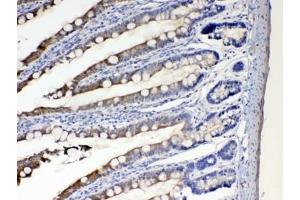 IHC testing of FFPE rat intestine tissue with CYP2D6 antibody at 1ug/ml. (CYP2D6 antibody  (AA 315-347))