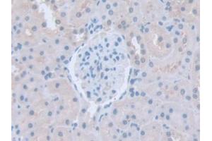 IHC-P analysis of Rat Kidney Tissue, with DAB staining. (ITSN1 antibody  (AA 1-227))