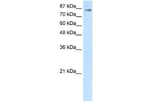WB Suggested Anti-SMARCA3 Antibody Titration:  5. (HLTF antibody  (C-Term))