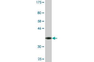 Western Blot detection against Immunogen (36. (MAP3K13 antibody  (AA 711-810))