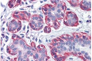 Human Breast: Formalin-Fixed, Paraffin-Embedded (FFPE) (ZYX antibody  (AA 1-573))