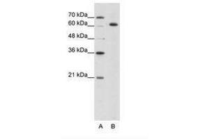 Image no. 2 for anti-Small Nuclear Ribonucleoprotein 70kDa (U1) (SNRNP70) (AA 21-70) antibody (ABIN203140) (SNRNP70 antibody  (AA 21-70))