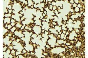 ABIN6267185 at 1/100 staining Mouse lung tissue by IHC-P.
