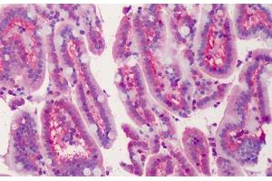 Human Small Intestine: Formalin-Fixed, Paraffin-Embedded (FFPE) (LASP1 antibody  (AA 141-153))