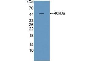 Detection of Recombinant MSE, Human using Polyclonal Antibody to Enolase 3 (ENO3) (ENO3 antibody  (AA 1-391))