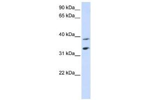 SLC25A34 antibody used at 1 ug/ml to detect target protein.