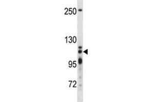 XRN2 antibody western blot analysis in T47D lysate (XRN2 antibody  (AA 48-76))