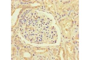 Immunohistochemistry (IHC) image for anti-Hypoxia Inducible Factor 1, alpha Subunit Inhibitor (HIF1AN) (AA 2-254) antibody (ABIN7156025)