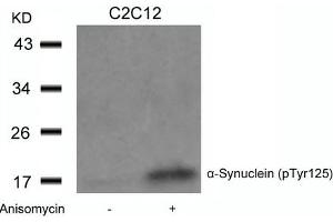 Western blot analysis of extracts from C2C12 cells untreated or treated with Anisomycin using a-Synuclein(Phospho-Tyr125) Antibody. (SNCA antibody  (pTyr125))