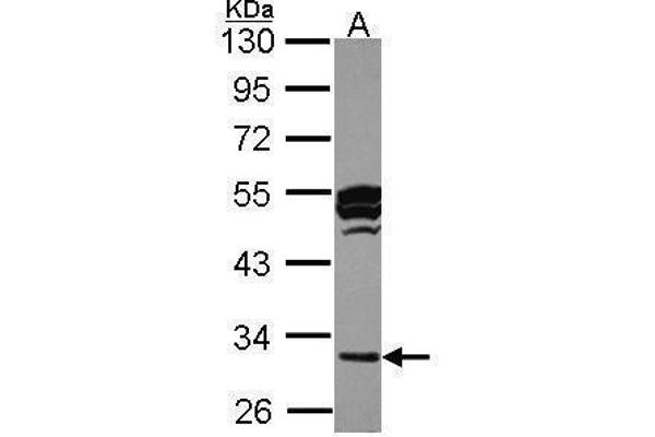 CTSO antibody
