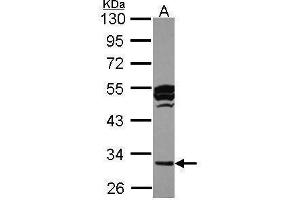 WB Image Sample (30 ug of whole cell lysate) A: HCT116 10% SDS PAGE antibody diluted at 1:1000 (CTSO antibody)