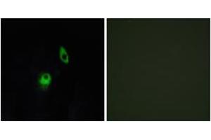 Immunofluorescence analysis of HeLa cells, using GPR124 Antibody. (GPR124 antibody  (AA 1151-1200))