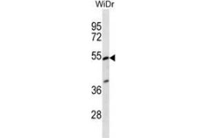 Western blot analysis in WiDr cell line lysates (35ug/lane) using PIGV  Antibody (C-term). (PIGV antibody  (C-Term))