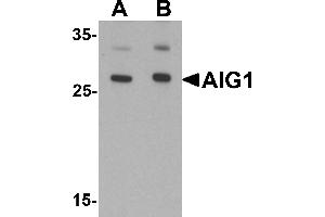Western blot analysis of AIG1 in human brain tissue lysate with AIG1 antibody at (A) 1 and (B) 2 µg/mL. (AIG1 antibody  (N-Term))
