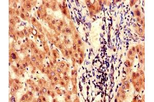 Immunohistochemistry of paraffin-embedded human liver tissue using ABIN7153235 at dilution of 1:100 (FAH antibody  (AA 2-250))
