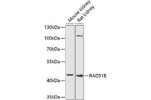 Western blot analysis of extracts of various cell lines, using RB antibody (ABIN6132613, ABIN6146640, ABIN6146643 and ABIN6222714) at 1:1000 dilution. (RAD51 Homolog B antibody  (AA 1-384))