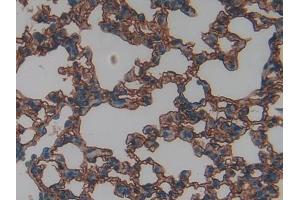 Immunohistochemistry (IHC) image for anti-Intercellular Adhesion Molecule 1 (ICAM1) (AA 46-301) antibody (ABIN1077699)