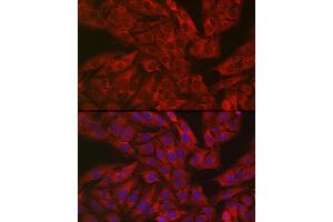 Immunofluorescence analysis of U2OS cells using GSDME antibody (ABIN6127757, ABIN6139554, ABIN6139555 and ABIN6223304) at dilution of 1:50. (Non-Syndromic Hearing Impairment Protein 5 (GSDME) (AA 1-260) antibody)