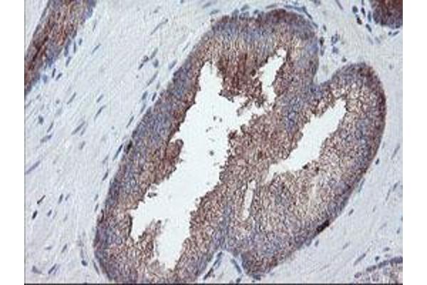 Carboxypeptidase A2 antibody