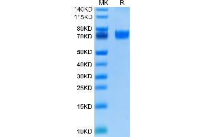 VTCN1 Protein (AA 33-194) (Fc Tag)