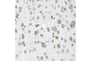 Immunohistochemistry of paraffin-embedded mouse brain using CDH23 antibody (ABIN5971471) at dilution of 1/100 (40x lens). (CDH23 antibody)