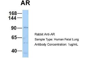 Host: Rabbit Target Name: AR Sample Type: Human Fetal Lung Antibody Dilution: 1.