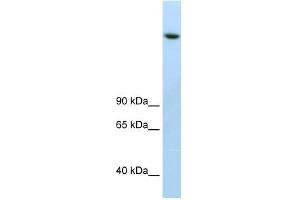 WB Suggested Anti-JMJD1B Antibody Titration:  2. (KDM3B antibody  (C-Term))