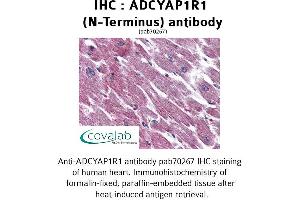 Image no. 2 for anti-Adenylate Cyclase Activating Polypeptide 1 (Pituitary) Receptor Type I (ADCYAP1R1) (Extracellular Domain), (N-Term) antibody (ABIN1731541)