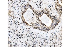 IHC analysis of KHSRP using anti-KHSRP antibody (ABIN7599776).