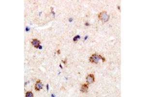 Immunohistochemical analysis of MYPT1 staining in human brain formalin fixed paraffin embedded tissue section. (PPP1R12A antibody)