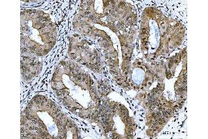 IHC analysis of CSNK2K2 using anti-CSNK2K2 antibody (ABIN7602871). (CSNK2A2 antibody  (C-Term))