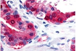 Anti-TRPM8 antibody  ABIN1049435 IHC staining of human prostate. (TRPM8 antibody  (Internal Region))