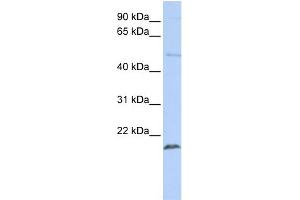 WB Suggested Anti-ZNF79 Antibody Titration:  0.