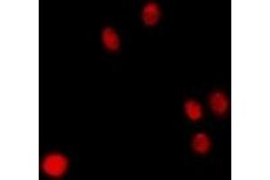 Immunofluorescent analysis of p47 staining in Hela cells. (CLEC11A antibody)