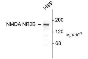 Image no. 1 for anti-Glutamate Receptor, Ionotropic, N-Methyl D-Aspartate 2B (GRIN2B) (C-Term) antibody (ABIN372682) (GRIN2B antibody  (C-Term))