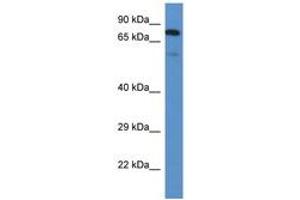 Image no. 1 for anti-UDP-N-Acetyl-alpha-D-Galactosamine:polypeptide N-Acetylgalactosaminyltransferase 3 (GalNAc-T3) (GALNT3) (AA 93-142) antibody (ABIN6746270) (GALNT3 antibody  (AA 93-142))