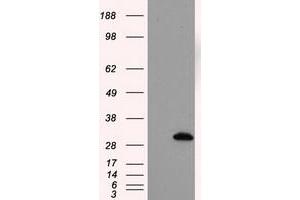 Image no. 1 for anti-Thiopurine S-Methyltransferase (TPMT) antibody (ABIN1501483) (TPMT antibody)
