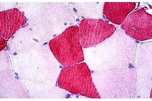 Human Skeletal Muscle: Formalin-Fixed, Paraffin-Embedded (FFPE) (UBE2O antibody  (AA 1279-1292))