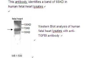 Image no. 1 for anti-Transforming Growth Factor, beta-Induced, 68kDa (TGFBI) antibody (ABIN790807) (TGFBI antibody)