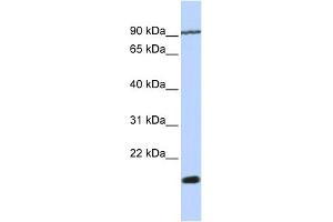 WB Suggested Anti-TM4SF4 Antibody Titration:  0.