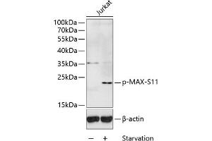 Western blot analysis of extracts of Jurkat cells, using Phospho-MAX-S11 antibody (ABIN3019514, ABIN3019515, ABIN3019516 and ABIN6225442) at 1:1000 dilution.
