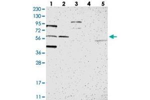 Western blot analysis of Lane 1: RT-4, Lane 2: U-251 MG, Lane 3: Human Plasma, Lane 4: Liver, Lane 5: Tonsil with C1orf116 polyclonal antibody .