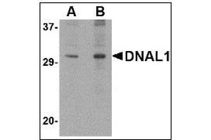 Western blot analysis of DNAL1 in 3T3 cell lysate with DNAL1 antibody at (A) 1 and (B) 2 µg/ml.