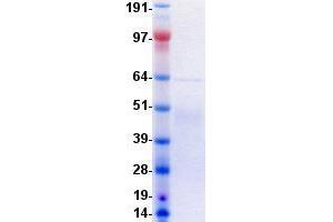 Western Blotting (WB) image for Insulin Receptor (INSR) protein (DYKDDDDK-His Tag) (ABIN5505576)