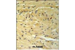 GNAT1 Antibody (C-term) (ABIN653740 and ABIN2843042) IHC analysis in formalin fixed and paraffin embedded moouse heart tissue followed by peroxidase conjugation of the secondary antibody and DAB staining. (GNAT1 antibody  (C-Term))