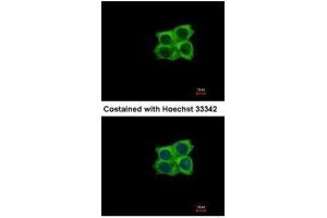 ICC/IF Image Immunofluorescence analysis of methanol-fixed A431, using Ladinin 1, antibody at 1:500 dilution. (Ladinin 1 antibody  (C-Term))